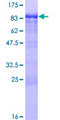 CCDC6 Protein - 12.5% SDS-PAGE of human CCDC6 stained with Coomassie Blue