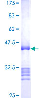 CCDC6 Protein - 12.5% SDS-PAGE Stained with Coomassie Blue.