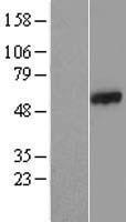 CCDC65 Protein - Western validation with an anti-DDK antibody * L: Control HEK293 lysate R: Over-expression lysate