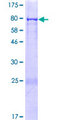 CCDC65 Protein - 12.5% SDS-PAGE of human CCDC65 stained with Coomassie Blue