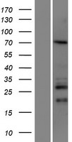 CCDC67 Protein - Western validation with an anti-DDK antibody * L: Control HEK293 lysate R: Over-expression lysate