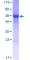 CCDC69 Protein - 12.5% SDS-PAGE of human CCDC69 stained with Coomassie Blue