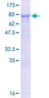 CCDC76 Protein - 12.5% SDS-PAGE of human CCDC76 stained with Coomassie Blue