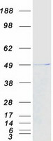 CCDC78 Protein - Purified recombinant protein CCDC78 was analyzed by SDS-PAGE gel and Coomassie Blue Staining