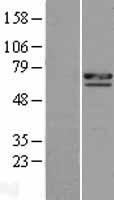 CCDC8 Protein - Western validation with an anti-DDK antibody * L: Control HEK293 lysate R: Over-expression lysate