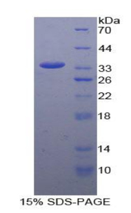 CCDC80 Protein - Recombinant Coiled Coil Domain Containing Protein 80 By SDS-PAGE