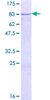 CCDC83 Protein - 12.5% SDS-PAGE of human CCDC83 stained with Coomassie Blue