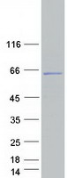 CCDC83 Protein - Purified recombinant protein CCDC83 was analyzed by SDS-PAGE gel and Coomassie Blue Staining