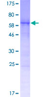 CCDC84 Protein - 12.5% SDS-PAGE of human CCDC84 stained with Coomassie Blue
