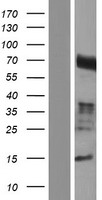 CCDC85A Protein - Western validation with an anti-DDK antibody * L: Control HEK293 lysate R: Over-expression lysate