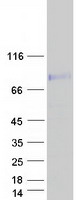 CCDC85A Protein - Purified recombinant protein CCDC85A was analyzed by SDS-PAGE gel and Coomassie Blue Staining