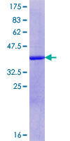 CCDC85B Protein - 12.5% SDS-PAGE Stained with Coomassie Blue.