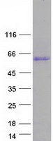 CCDC85C Protein - Purified recombinant protein CCDC85C was analyzed by SDS-PAGE gel and Coomassie Blue Staining