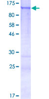 CCDC87 Protein - 12.5% SDS-PAGE of human CCDC87 stained with Coomassie Blue