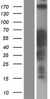 CCDC88C Protein - Western validation with an anti-DDK antibody * L: Control HEK293 lysate R: Over-expression lysate