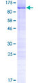 CCDC9 Protein - 12.5% SDS-PAGE of human CCDC9 stained with Coomassie Blue