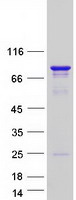 CCDC9 Protein - Purified recombinant protein CCDC9 was analyzed by SDS-PAGE gel and Coomassie Blue Staining