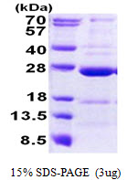 CCDC90B Protein