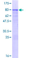 CCDC91 Protein - 12.5% SDS-PAGE of human CCDC91 stained with Coomassie Blue