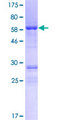 CCDC92 Protein - 12.5% SDS-PAGE of human CCDC92 stained with Coomassie Blue
