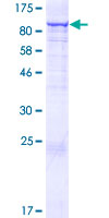 CCDC93 Protein - 12.5% SDS-PAGE of human CCDC93 stained with Coomassie Blue