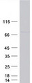 CCDC93 Protein - Purified recombinant protein CCDC93 was analyzed by SDS-PAGE gel and Coomassie Blue Staining