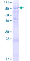 CCIN / Calicin Protein - 12.5% SDS-PAGE of human CCIN stained with Coomassie Blue
