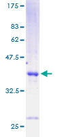 CCK / Cholecystokinin Protein - 12.5% SDS-PAGE of human CCK stained with Coomassie Blue