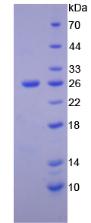 CCK4 / PTK7 Protein - Recombinant Tyrosine Protein Kinase 7 (PTK7) by SDS-PAGE