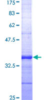 CCKBR / Cckb Protein - 12.5% SDS-PAGE Stained with Coomassie Blue.
