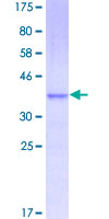 CCL11 / Eotaxin Protein - 12.5% SDS-PAGE of human CCL11 stained with Coomassie Blue