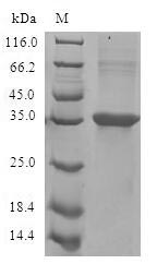 CCL11 / Eotaxin Protein - (Tris-Glycine gel) Discontinuous SDS-PAGE (reduced) with 5% enrichment gel and 15% separation gel.