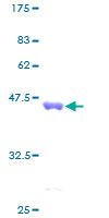 CCL13 / MCP4 Protein - 12.5% SDS-PAGE of human CCL13 stained with Coomassie Blue