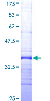 CCL14 Protein - 12.5% SDS-PAGE Stained with Coomassie Blue.