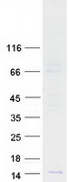 CCL14 Protein - Purified recombinant protein CCL14 was analyzed by SDS-PAGE gel and Coomassie Blue Staining