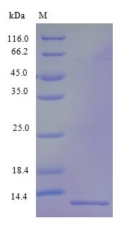 CCL15 / MIP5 Protein