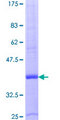 CCL15 / MIP5 Protein - 12.5% SDS-PAGE of human CCL15 stained with Coomassie Blue
