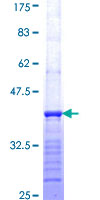 CCL15 / MIP5 Protein - 12.5% SDS-PAGE Stained with Coomassie Blue.