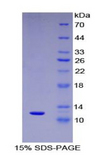 CCL15 / MIP5 Protein - Recombinant Macrophage Inflammatory Protein 5 By SDS-PAGE