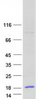 CCL15 / MIP5 Protein - Purified recombinant protein CCL15 was analyzed by SDS-PAGE gel and Coomassie Blue Staining