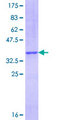 CCL16 / LEC Protein - 12.5% SDS-PAGE Stained with Coomassie Blue.
