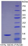 CCL16 / LEC Protein