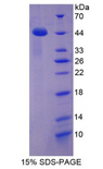 CCL16 / LEC Protein - Recombinant Chemokine C-C-Motif Ligand 16 By SDS-PAGE