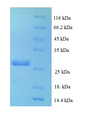 CCL16 / LEC Protein