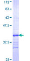 CCL17 / TARC Protein - 12.5% SDS-PAGE Stained with Coomassie Blue.