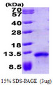 CCL17 / TARC Protein
