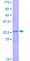 CCL18 / PARC Protein - 12.5% SDS-PAGE of human CCL18 stained with Coomassie Blue