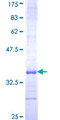 CCL18 / PARC Protein - 12.5% SDS-PAGE Stained with Coomassie Blue.