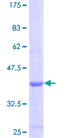 CCL19 / MIP3-Beta Protein - 12.5% SDS-PAGE of human CCL19 stained with Coomassie Blue