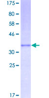 CCL2 / MCP1 Protein - 12.5% SDS-PAGE of human CCL2 stained with Coomassie Blue